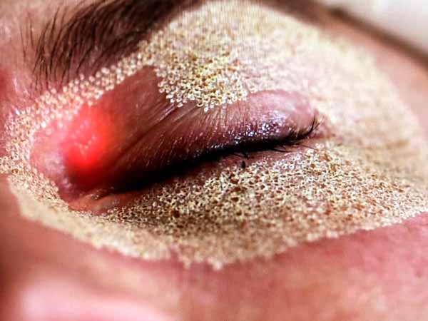 چشم های خانم درحال جوانسازی است. زیر چشم خانم پودرهایی وجود دارد.