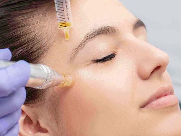 یک خانم روی تخت دراز کشیده است. چشمان خود را بسته است. در حال انجام جوانسازی به صورت مزونیدلینگ می باشد. موهای قهوه ای دارد. صورت خانم صاف و بدون چروک است.