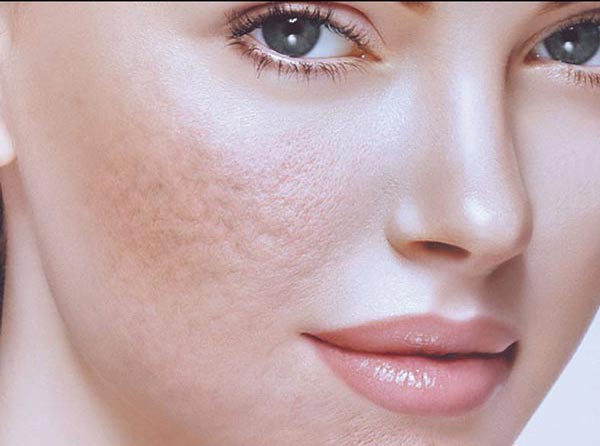 خانمی در عکس وجود دارد که مقداری چین و چروک در صورت خود دارد.چشم های خانم رنگی می باشد