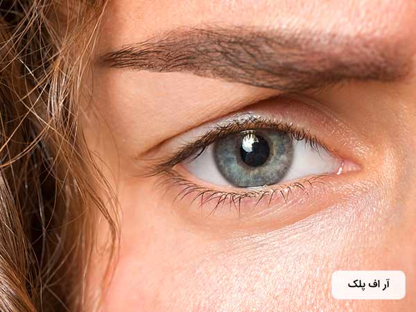 چشم يک خانم در تصوير قابل مشاهده مي باشد.