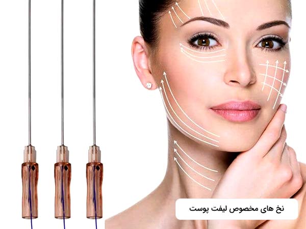 در تصوير انواع مختلف نخ مخصوص براي جوانسازي پوست به روش ليفت نخ را مشاهده مي کنيد. خانمی نیز در تصویر وجود دارد که صورت صاف و شفافی دارد.