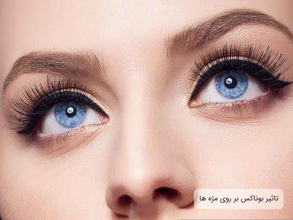 تاثیرات اعمال ماده بوتاکس به مژه ها کاملا در تصویر مشخص می باشد. این تصویر بسته از صورت یک خانم با چشمان آبی می باشد