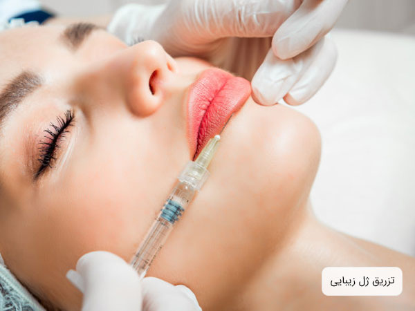 تصویری از صورت یک دختر خانم که توسط پزشک در حال تزریق ژل می باشد . زمینه تصویر سفید و دستکش دکتر سفید رنگ . همچنین تصویر بسته از صورت است و سرنگ کاملا در تصویر مشهود می باشد