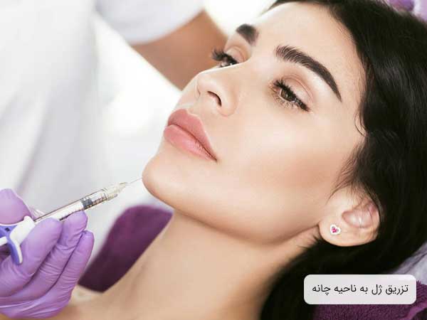 تصویر دختر خانمی در حال تزریق ژل به ناحیه چانه . زمینه تصویر سفید بوده و شکل سرنگ کاملا آشکار می باشد