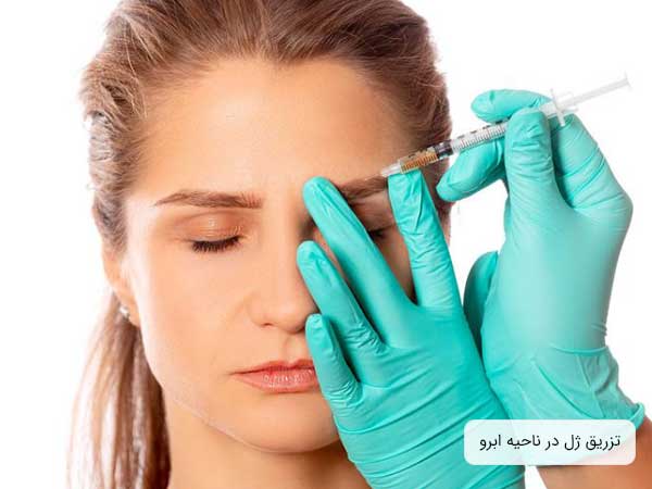 تصویر دختر خانمی در حال تزریق ژل به ناحیه ابرو. زمینه تصویر سفید بوده و شکل سرنگ کاملا آشکار می باشد. همچنین صورت پزشک معالج هم در تصویر نمایان است، دستکش های پزشک سبز فسفری می باشد