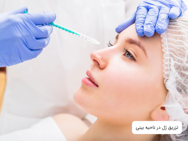 تصویر یک خانم نشسته در حال تزریق ژل در ناحیه بینی برای پرکنندگی جای خالی روی بینی یا همان قوز بینی توسط پزشک است . دستکش پزشک آبی رنگ و زمینه تصویر سفید می باشد . همچنین سرنگ کا ملا در تصویر نمایان است. همچنین تصویر یک عدد ژل تزریق برای ناحیه صورت مشاهده می شود