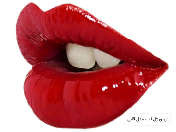 "تصویر