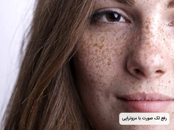 خانم روي صورت خود لک و کک و مک زيادي دارد.