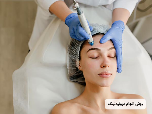 در تصوير خانمي روي تخت دراز کشيده است و چشمان خود را بسته است. پزشک با استفاده از قلم مخصوص مزونیدلینگ در حال زيباسازي و ترميم پوست خانم جوان مي باشد.
