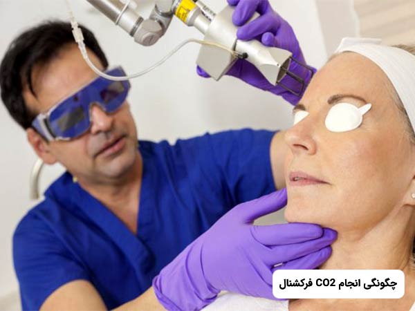 خانم روي تخت دراز کشيده و پزشک در حال درمان پوست او بوسيله CO2 فرکشنال مي باشد.