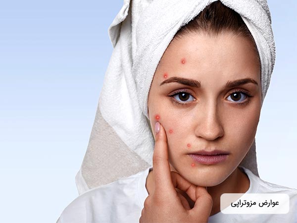 در تصوير خانمي را مشاهده مي کنيم که از صورت خود راضي نيست و دچار عوارض مزوتراپي شده است. روس صورت خانم لکه ها و جوش هاي ناخوشايندي وجود دارد. يک حوله سفيد بر روي سر خانم قرار دارد.