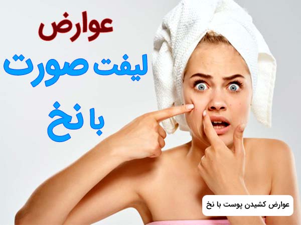 خانم از عوارض ليفت صورت با نخ نگران است و دارد با انگشت به آسيب بوجود آمده روي صورت خود اشاره مي کند.