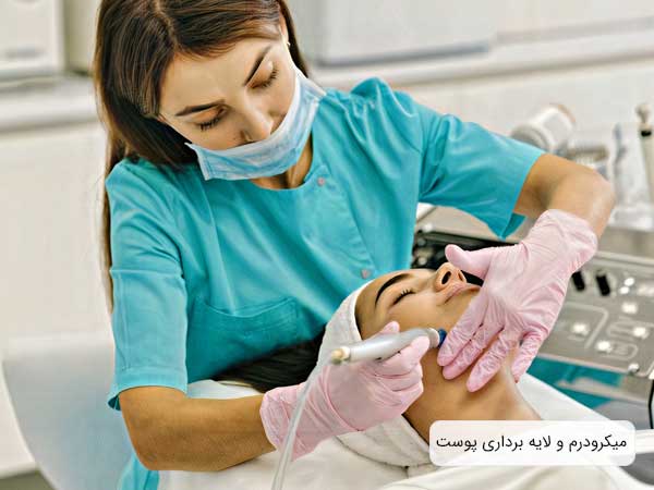 تصویر یک خانم در حال انجام میکرودرم و لایه برداری پوست صورت . لباس پزشک سبز و دستکششصورتی روشن می باشد