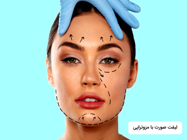 پوست صورت خانم بوسيله کشيدن با مزو زيبا و جوان شده است.