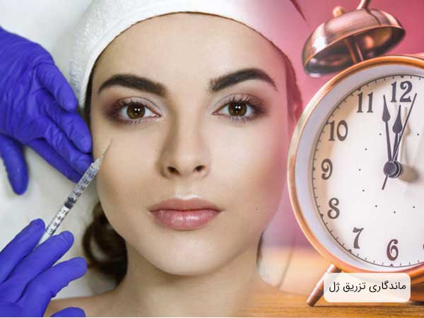 تصویر یک خانم در حال تزریق ژل و یک ساعت که میزان ماندگاری را در ذهن فرد تداعی می کند