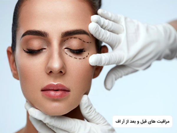 يک خانم در تصوير قرار دارد که چشم هاي خود را بسته است. خانم پوست شفاف و صافي دارد.
