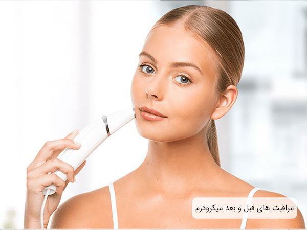 تصویر یک خانم با یک دستگاه میکرو درم در دست به دوربین نگاه می کند . زمینه تصویر سفید می باشد و دستگاه میکرودرم ابریژن در تصویر مشخص می باشد.