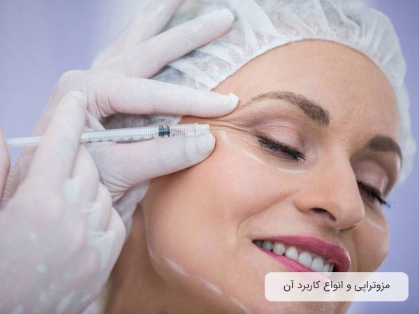 خانمي در تصوير مي باشد و در حال لبخند زدن است. خانم دندان هايي سفيد دارد و در حال انجام مزوتراپي براي جوانسازي دور چشم خود مي باشد. پزشک دستکش سفيد به دست کرده است و دارد چشم خانم را بوسيله مزوتراپی جوان مي کند.