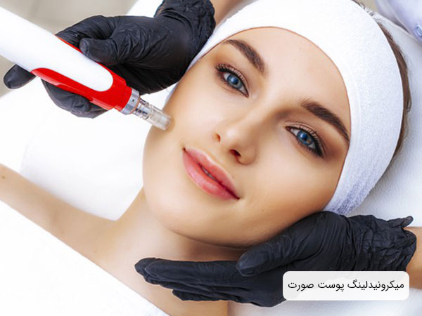 تصویر یک خانم زیبا خوابیده روس تخت در حال انجام میکرونیدلینگ پوست صورت توسط پزشک . زمینه تصویر و سربند بیمار سفید و دستکش های پزشک مشکی می باشد