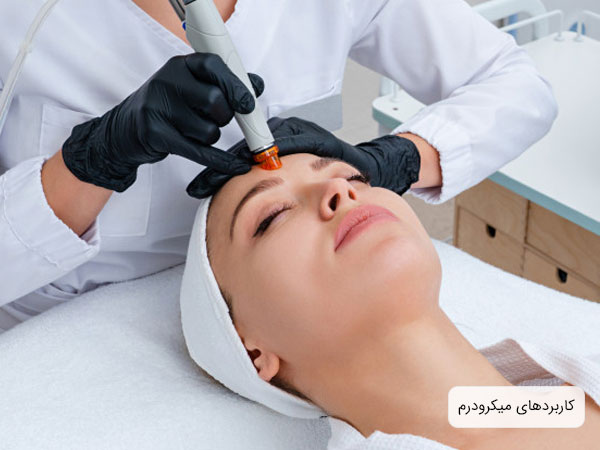 تصویر یک خانم در حال انجام میکرودرم با لباس سفید توسط دکتر با دستکش مشکی