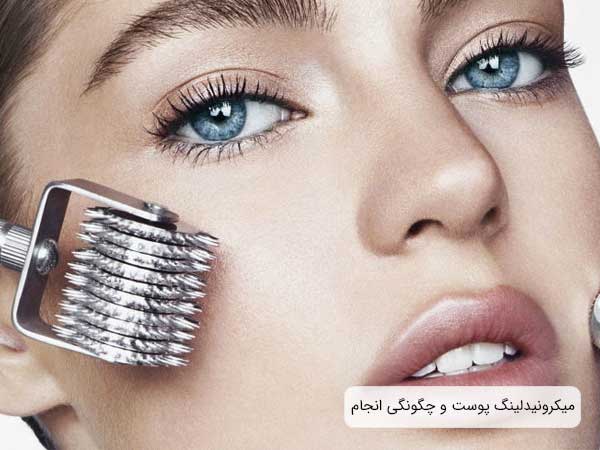 تصویر صورت خانمی در حال استفاده از دستگاه درما رولر برای صافی پوست خود . نمای صورت خانم بصورت بسته می باشد و رمینه تصویر سفید می باشد