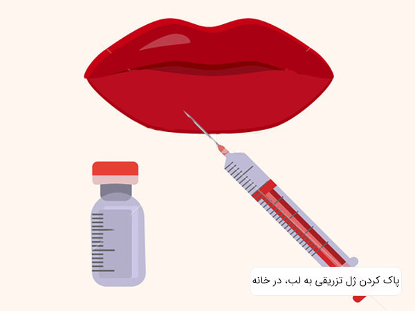 تصویر لب در حال تزریق ژل لب. ویال و سرنگ تزریق برای ژل لب در تصویر مشخص می باشد . همچنین زمنه تصویر سفید و روشن است.