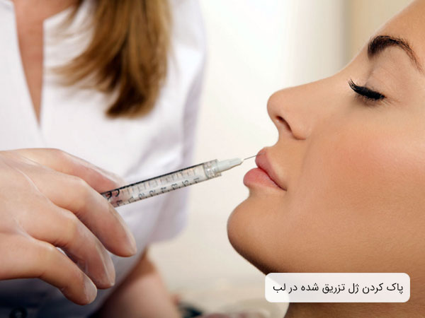 تصویر خانمی خوابیده روی تخت مطب پزشک درحال تخلیه ژل تزریق در لب خود توسط پزشکش. زمینه تصویر محو می باشد