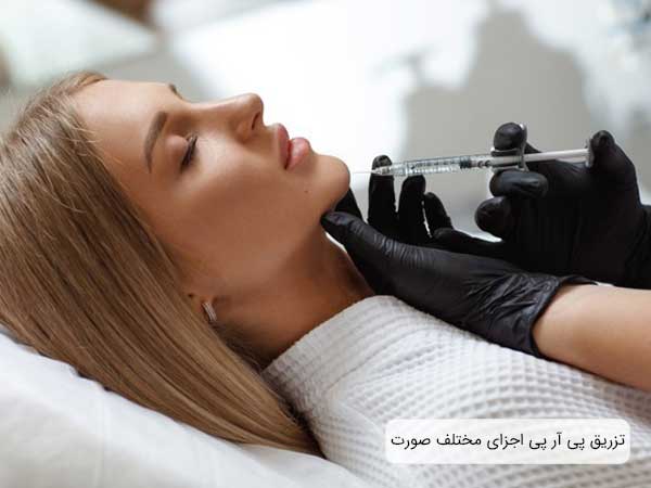 خانمی خوابیده بر روی تخت در حال تزریق پی ار پی اجزای صورت. تصویر سرنگ تزریق مشخص می باشد و همچنینن دستکش های پزشک سفید بوده و زمینه تصویر روشن می باشد