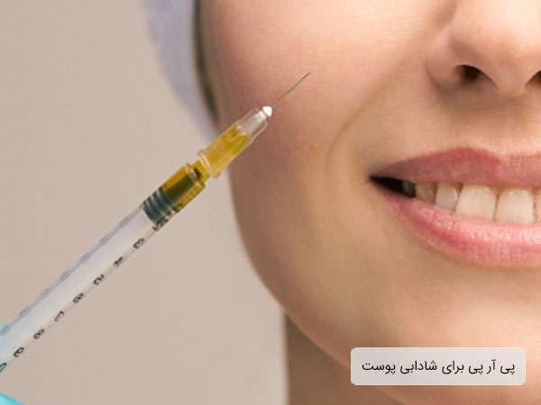 تصویر صورت صاف و شاداب یک خانم پس از انجام پی ار پی. سرنگت تزریق در تصویر نمایان است و همچنینن زمینه تصویر سفید و روشن است و تصویر خنده خانم کاملا مشخص است .