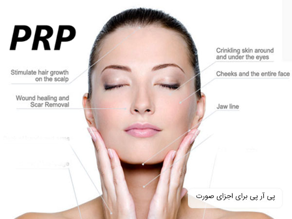 همه کاربردهای تزریق پی آر پی به اجزای صورت در تصویر نمایان است. تص.یر حروف پی آر پی و سر یک خانم در تصویر وجود دارد . زمینه تصویر کاملا سفید است