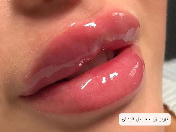 "تصویر