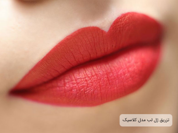 "تصویر