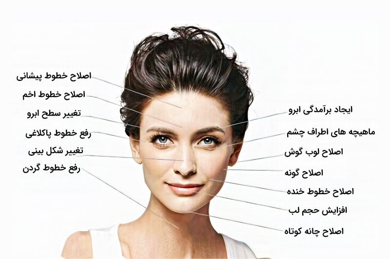 تصویر اجزای صورت یک خانم که مشمول استفاده از ژل نورامیس می باشد