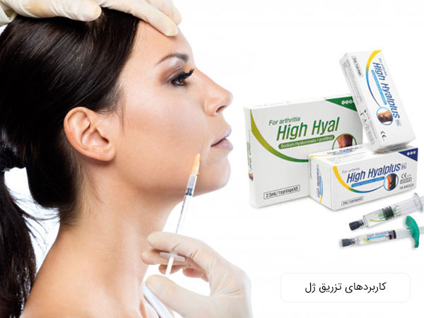تصویر نیمرخ یک خانم در حال تزریق ژل همچنین تصاویر تعدادی سرنگ و ویال تزریق ژل در تصویر با زمینه سفید نمایان است