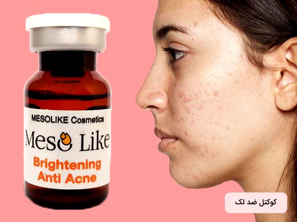 خانم روي صورت خود لک و جوش دازد. بايد از کوکتل ضد لک مزوتراپي صورت استفاده کند.