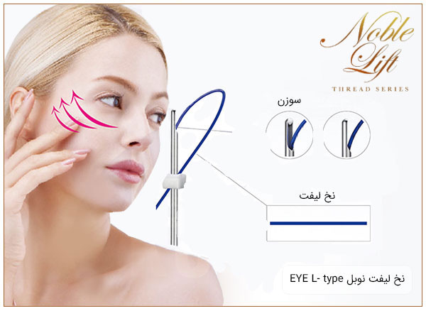 تصویری از یک دختر خانم با زمینه سفید درکنار یک نخ لیفت مونوی چشم نوبل