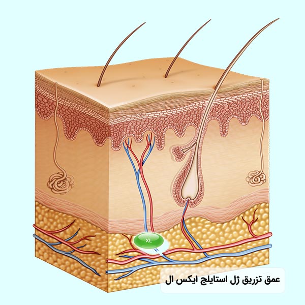 عمق تزريق فيلر استايلج مدل ايکس ال