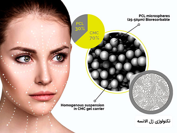 تکنولوژي استفاده شده در ساخت ژل و فيلر الانسه