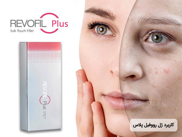 تاثیر ژل رووفيل پلاس کره بر روی صورت و لب