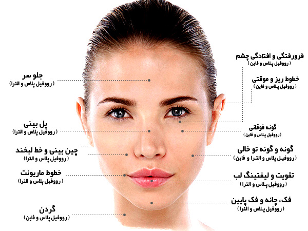 موارد کاربرد انواع ژل و فيلر رووفيل