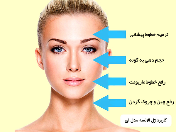 کاربرد و قيمت فيلر الانسه براي گونه