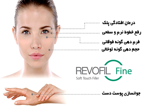 موارد کاربرد فيلر فاين رووفيل کره برای زیر چشم به همراه تصویر صورت یک خانم