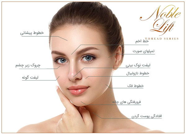 نخ لیفت مدل نوبل و موارد استفاده آن در صورت و گردن با زمینه سفید در تصویر مشاهده می شود