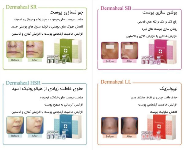 درماهیل مزو برای خرید و فروش . در تصویر ویژگی های مختلف برند درماهیل برای مزوتراپی مشخص می باشد