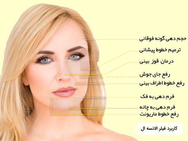 کاربرد ژل L الانسه هلند