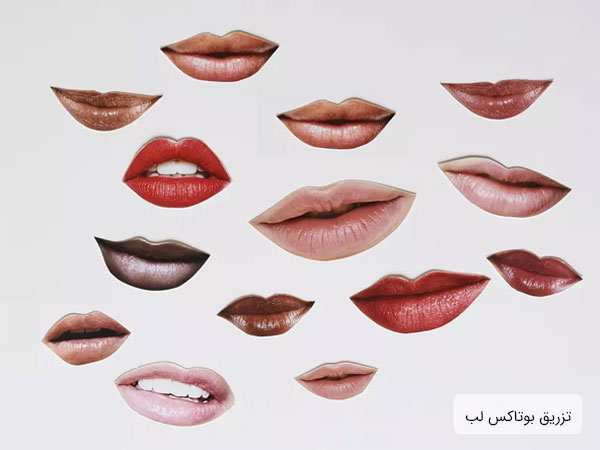 مدل ها و انواع مختلف تزربق بوتاکس لب را در تصویر مشاهده می کنیم