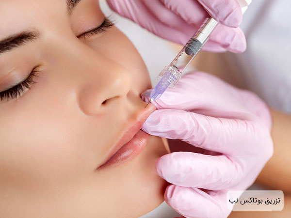 روش تزریق بوتاکس لب توسط خانم دکتر با دستکش های صورتی رنگ در تصویر مشخص می باشد