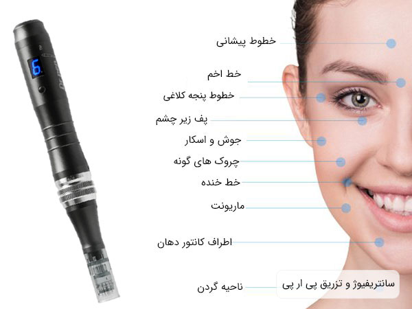 تصویری از نواحی مختلف صورت یک خانم که مشمول استفاده از دکتر پن M8 می باشد
