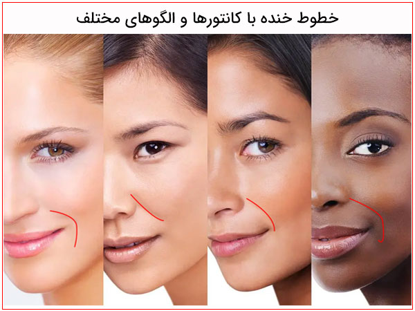 تصاویر چهار خانم با خط خنده ها مختلف در تصویر مشهود می باشد