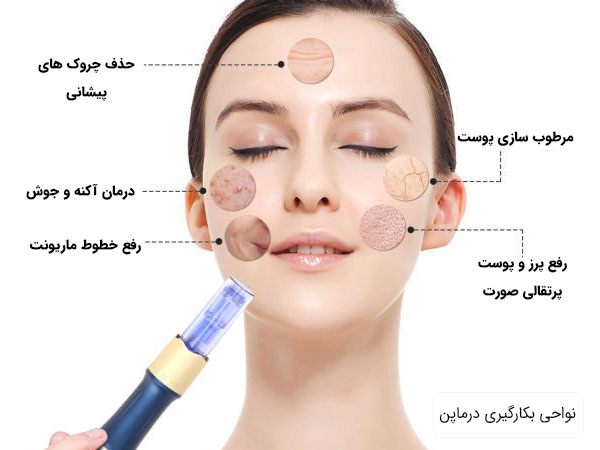 تصویر یک عدد درمارولر خانگی و درماپن با زمینه تصاویر دو خانم در تصویر مشص می باشد. این تصویر با شناخت میکرونیدلینگ و درمارولر خانگی درارتباط می باشد